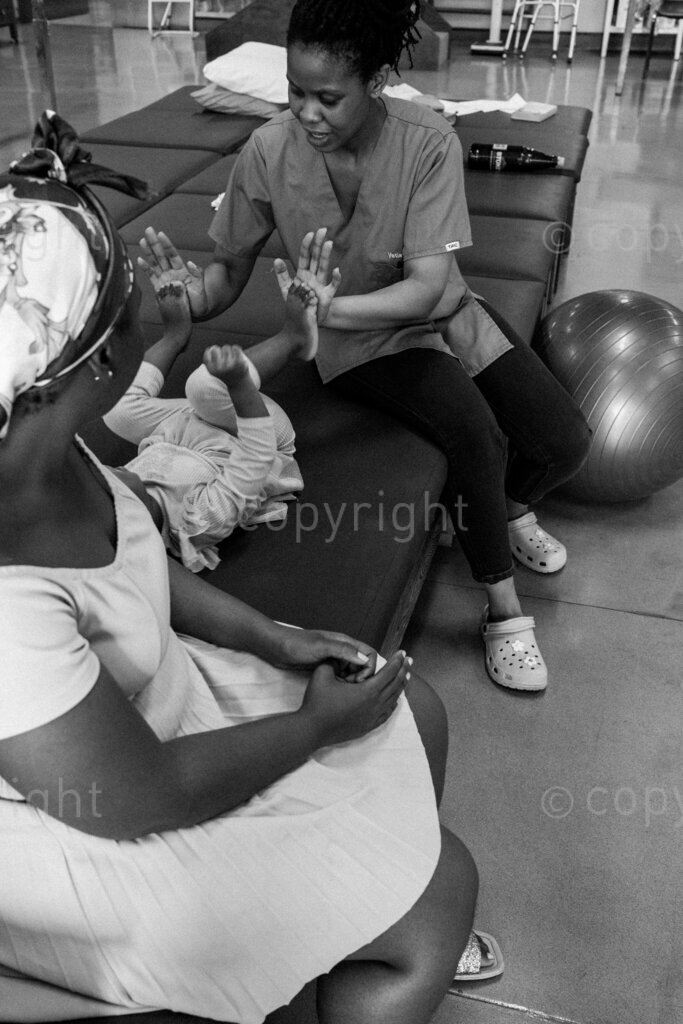 A physiotherapist treats and exercises a little girl with a congenital condition. 22, 23, Feb. 2024, Pietermaritzburg, KwaZulu Natal, South Africa.