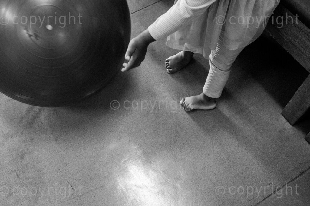 A little girl interacts with an exercise ball on her way to healing. 22, 23, Feb. 2024, Pietermaritzburg, KwaZulu Natal, South Africa.