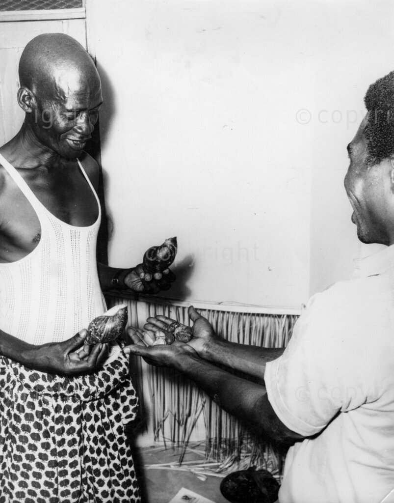 Nigeria Road Accident, then the driver is given kola nuts and sculls to eat. Now according to the medicine man he is immune to accidents.
